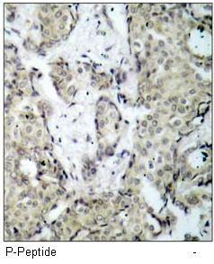 MKK3 (Phospho-Ser189) Antibody