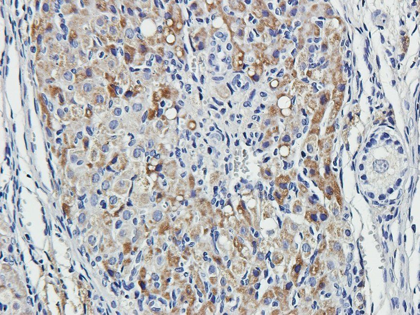 MKLP1 Rabbit Polyclonal Antibody