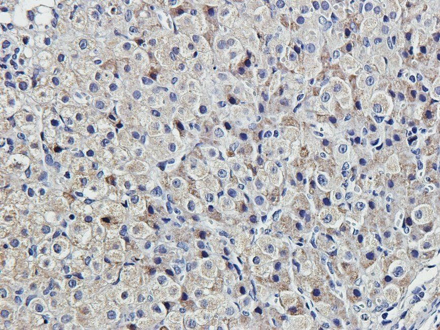 MKLP1 Rabbit Polyclonal Antibody
