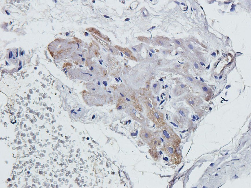 MKLP1 Rabbit Polyclonal Antibody