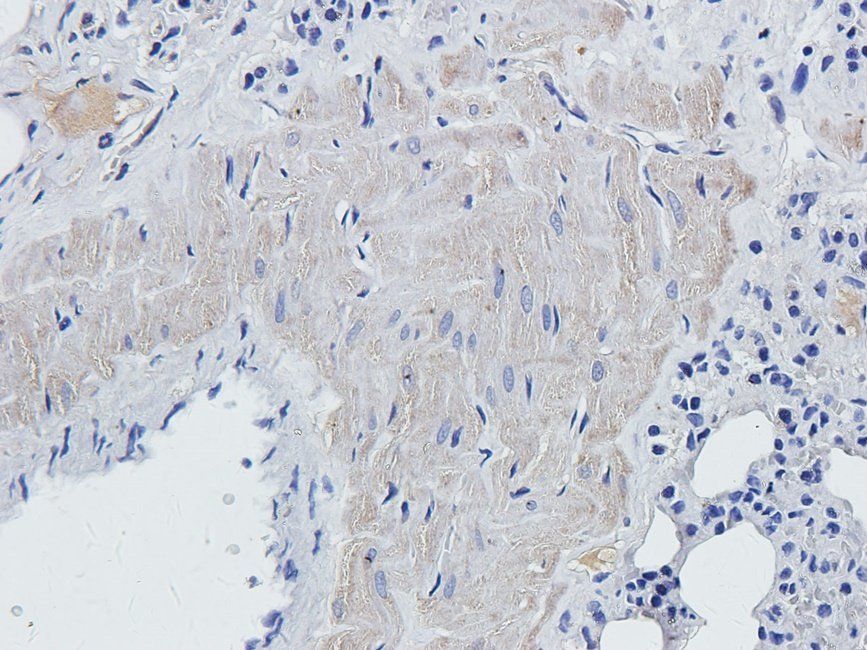 MKLP1 Rabbit Polyclonal Antibody