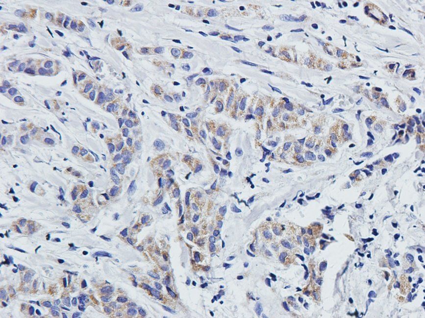 MKLP1 Rabbit Polyclonal Antibody