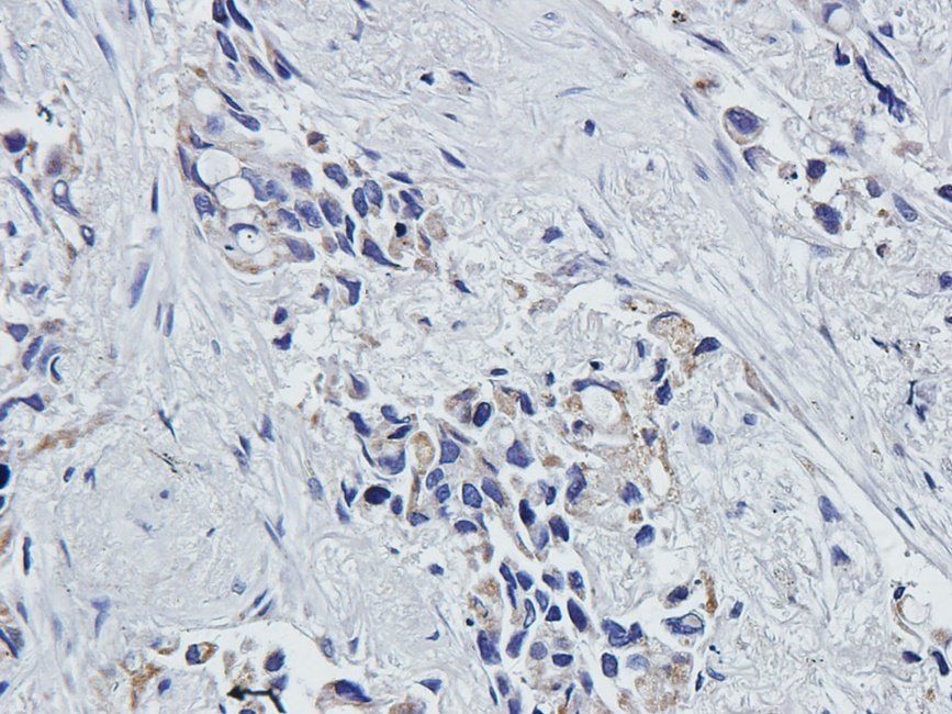 MKLP1 Rabbit Polyclonal Antibody