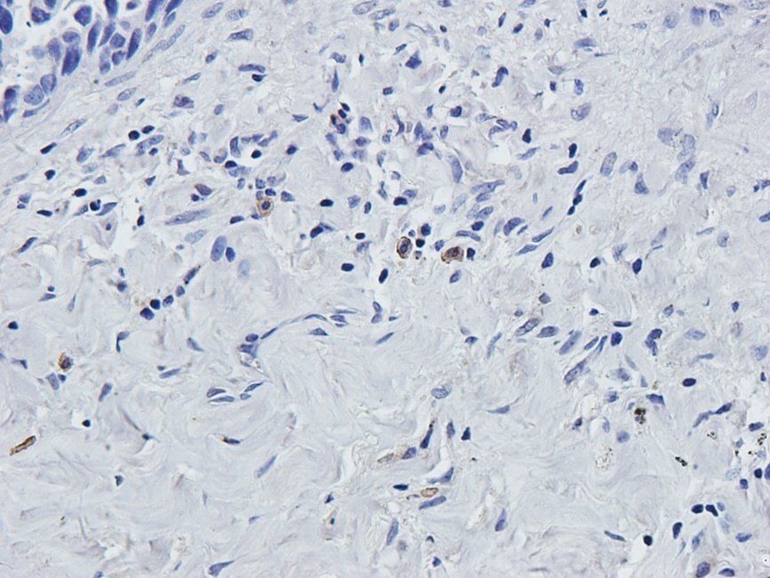 MKLP1 Rabbit Polyclonal Antibody