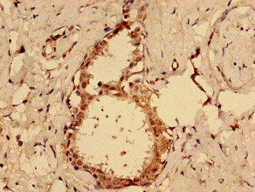 MKRN2 Antibody