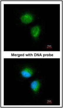 MMACHC Rabbit Polyclonal Antibody