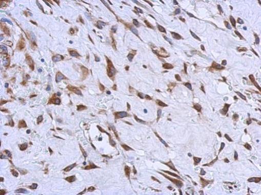 MMACHC Rabbit Polyclonal Antibody