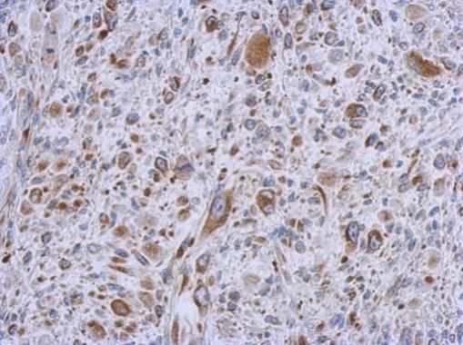 MMACHC Rabbit Polyclonal Antibody
