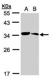 MMACHC Rabbit Polyclonal Antibody