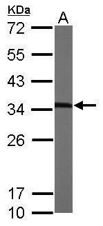 MMACHC Rabbit Polyclonal Antibody
