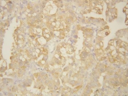 Matrix metalloproteinase-9 MMP9 Rabbit Polyclonal Antibody