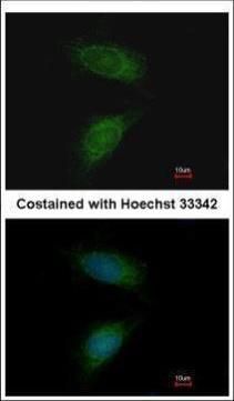 MMP2 Rabbit Polyclonal Antibody