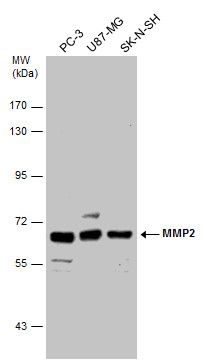 MMP2 Rabbit Polyclonal Antibody