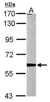 MMP2 Rabbit Polyclonal Antibody