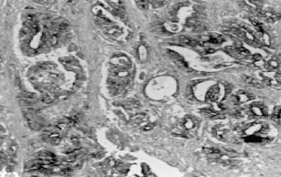Mouse anti Human Matrix Metalloproteinase 3 (MMP3) Antibody