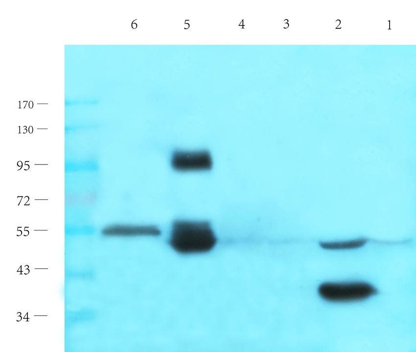 MMP3 Rabbit Polyclonal Antibody