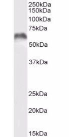 MMP3 (aa459-473) Antibody