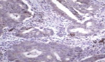 Mouse anti Human Matrix Metalloproteinase 9 (MMP9) Antibody