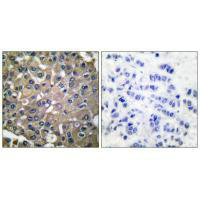 MMP9 Antibody