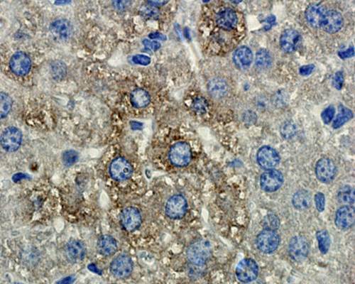 MMP9 Antibody