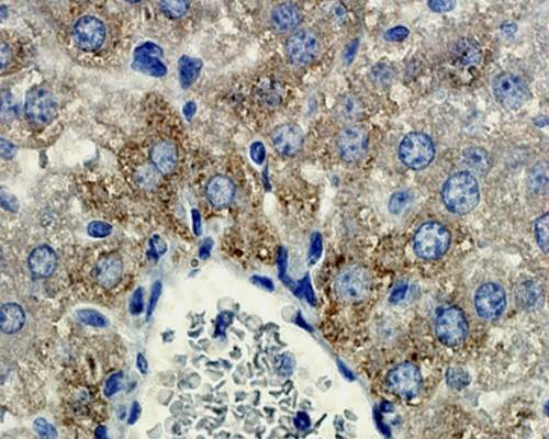 MMP9 Rabbit Polyclonal Antibody