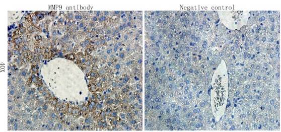 MMP9 Rabbit Polyclonal Antibody