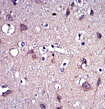MMP9 Antibody