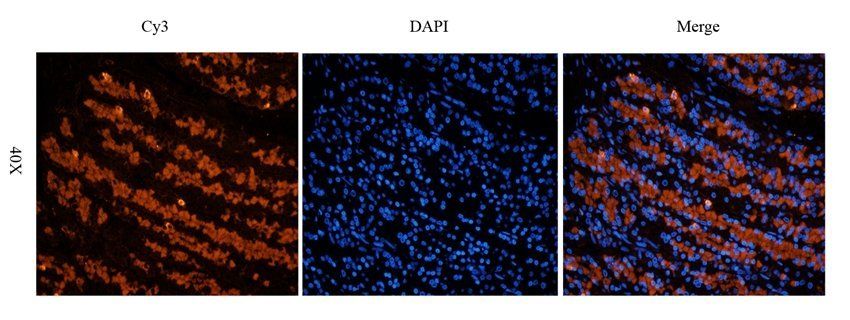 MOGAT1 Rabbit Polyclonal Antibody