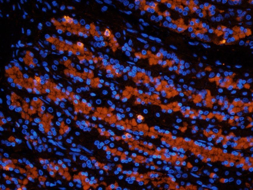 MOGAT1 Rabbit Polyclonal Antibody