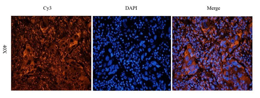 MOGAT1 Rabbit Polyclonal Antibody