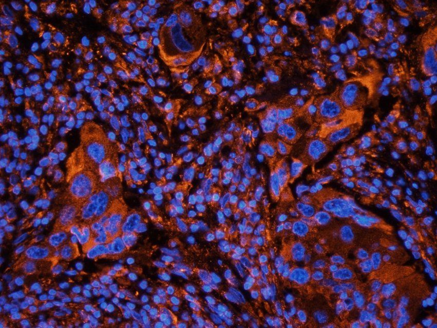 MOGAT1 Rabbit Polyclonal Antibody