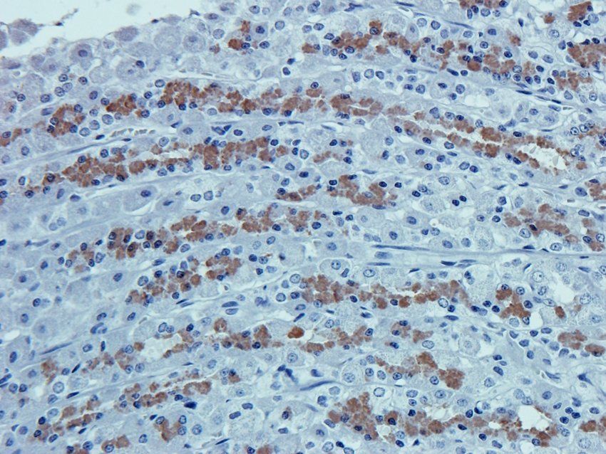 MOGAT1 Rabbit Polyclonal Antibody