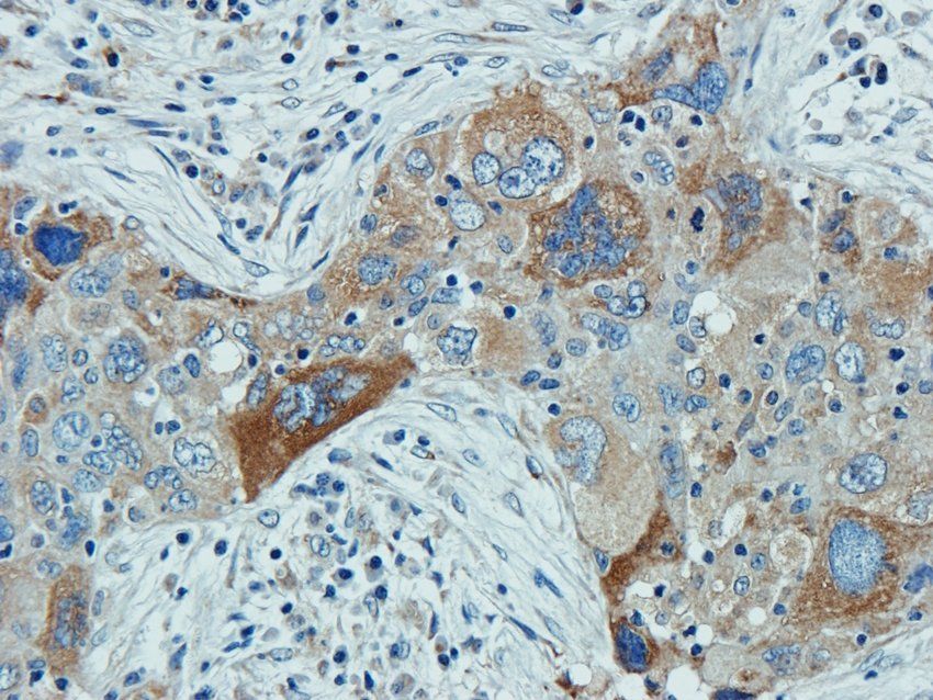 MOGAT1 Rabbit Polyclonal Antibody