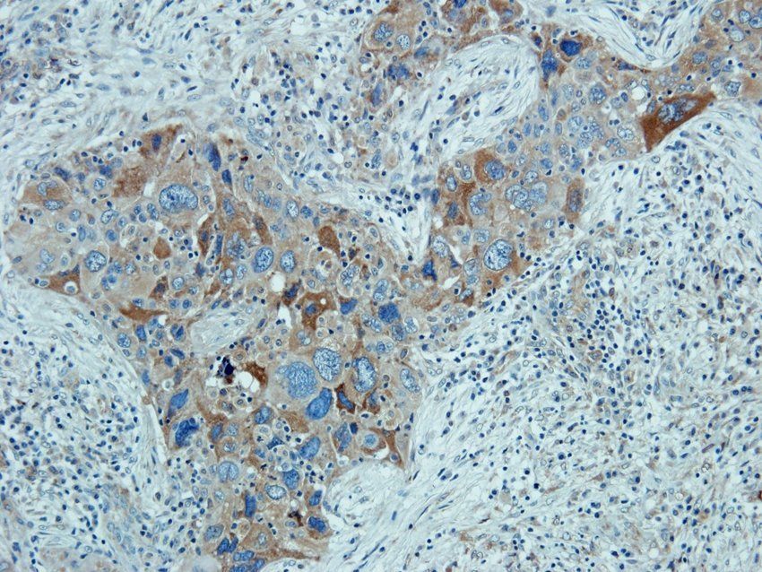 MOGAT1 Rabbit Polyclonal Antibody