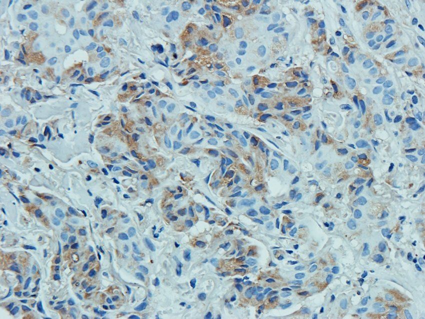 MOGAT1 Rabbit Polyclonal Antibody