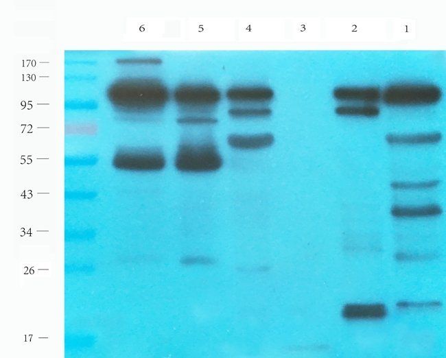 MOGAT1 Rabbit Polyclonal Antibody