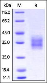 Cynomolgus / Rhesus macaque 4-1BB Protein, His Tag