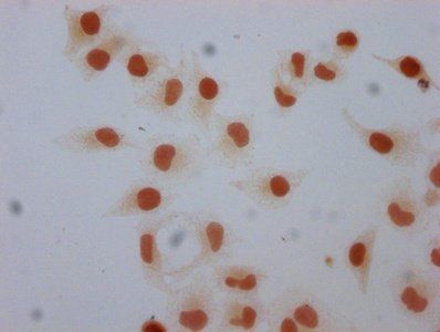 H1F0 Antibody