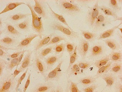HIST1H3A Antibody