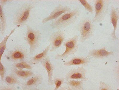 HIST1H3A Antibody