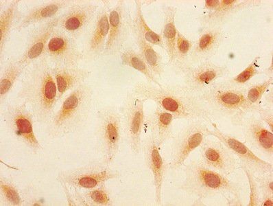 HIST1H3A Antibody