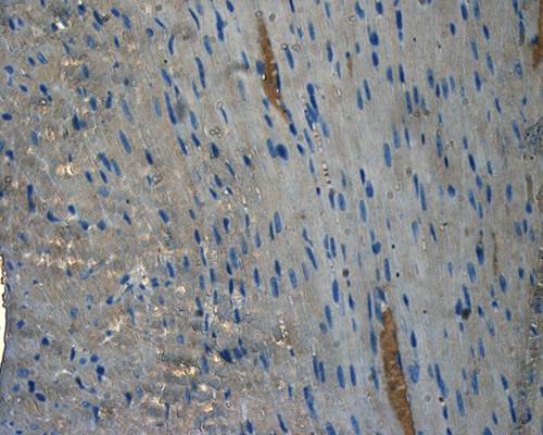 CD133 Rabbit Polyclonal Antibody