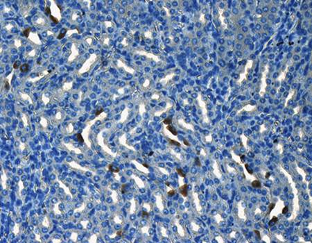 CD133 Rabbit Polyclonal Antibody