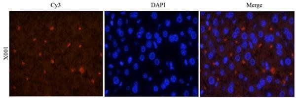 CD163 Rabbit Polyclonal Antibody