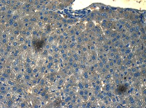 CD133 Rabbit Polyclonal Antibody