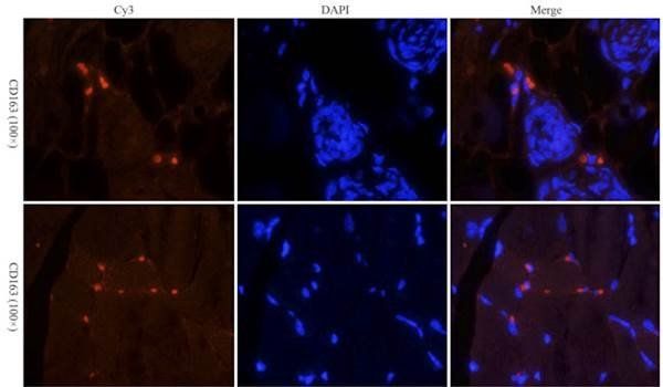 CD163 Rabbit Polyclonal Antibody