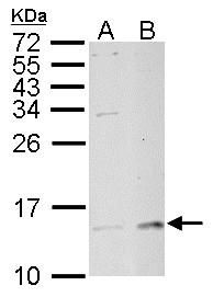 MP1 Rabbit Polyclonal Antibody