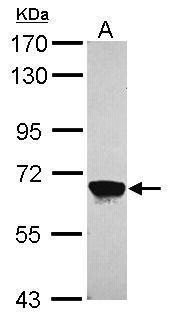 MPP2 Rabbit Polyclonal Antibody