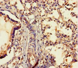 MRAP2 Antibody