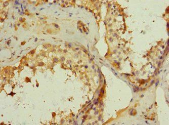 MRC2 Antibody